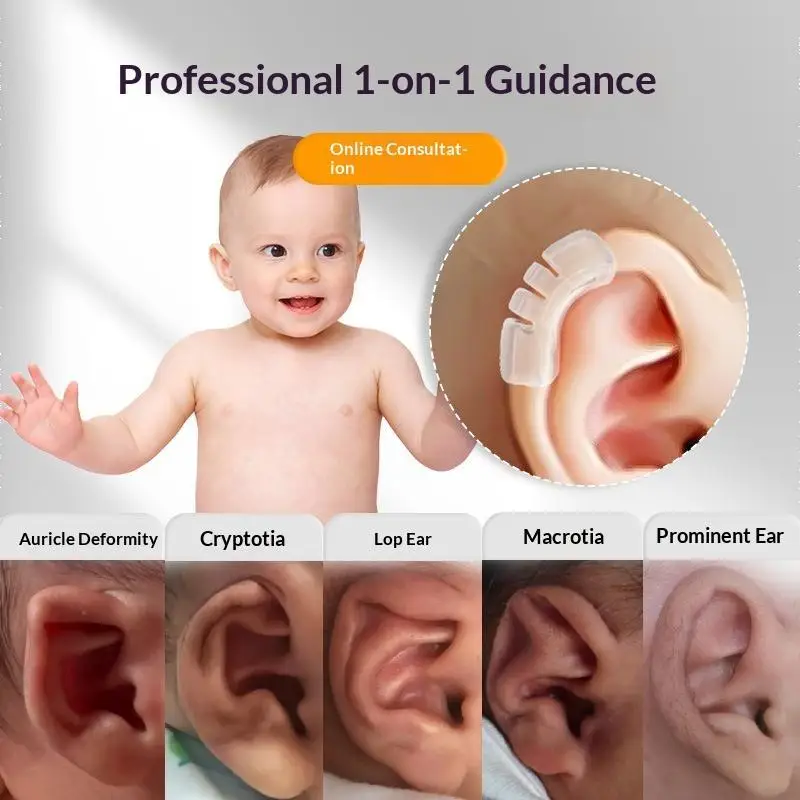 IInfant Ear Correction Device Soft Silicone Ear Shaping Mold For Newborns Baby Adjustable Design Transparent Comfortable