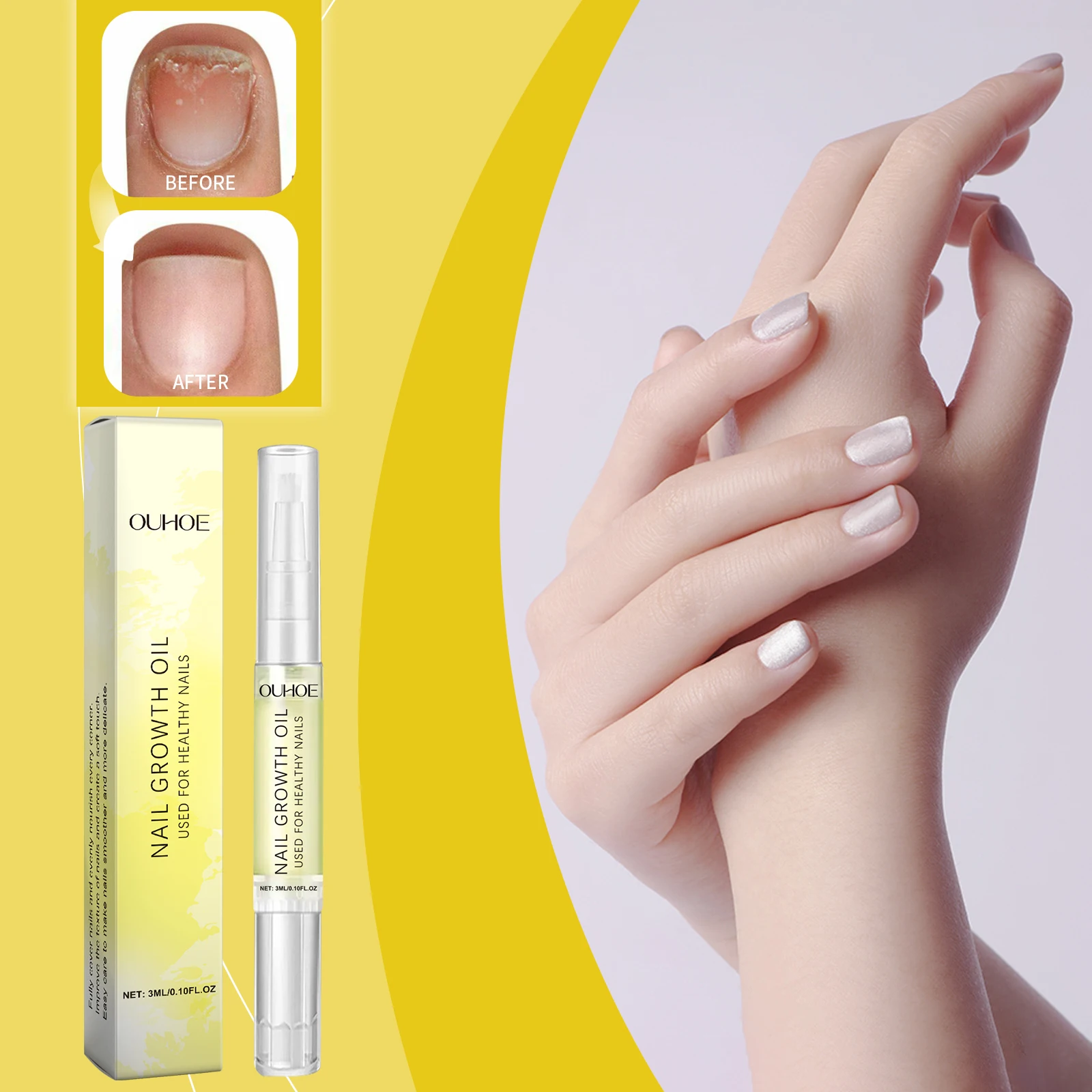 Nagelverzorgingsolie Dagelijkse zachte ingegroeide nagels Reinigende en hydraterende reparatieoplossing