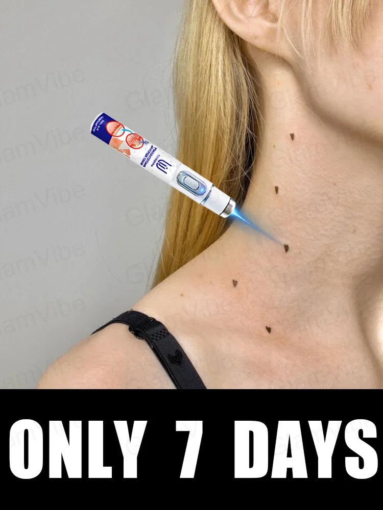 blue light pen solve warts, hot sale wart care tools