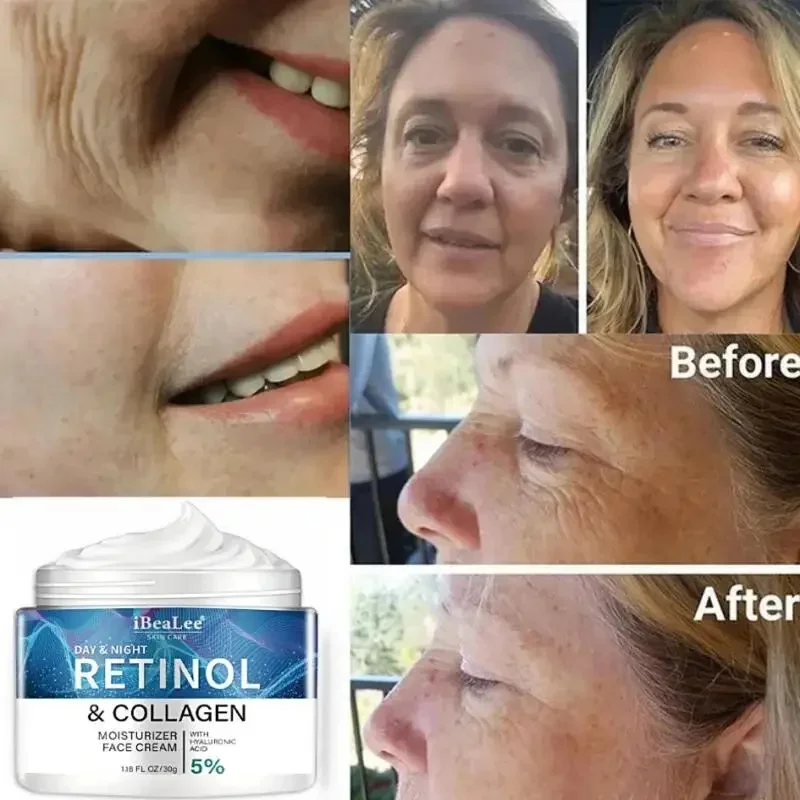 Retinol ครีมต่อต้านริ้วรอยสําหรับชาย Collagen Anti-Aging Removal Face & คอริ้วรอยที่มีประสิทธิภาพชุ่มชื่นกระชับเกาหลี Skin Care