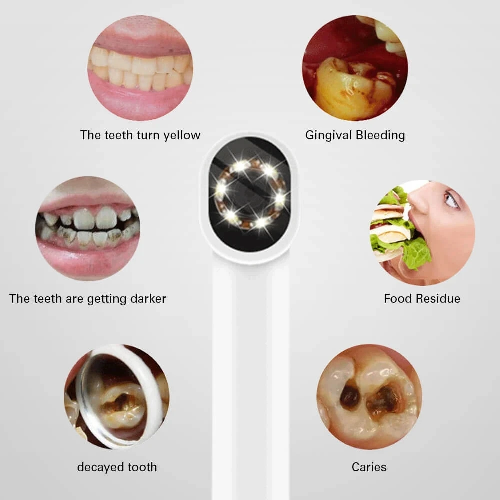 HD 480/1080P Intraoral Camera Visual Dental Instruments 3 in1 USB Dental Camera Capture Available with support Android PC Tablet