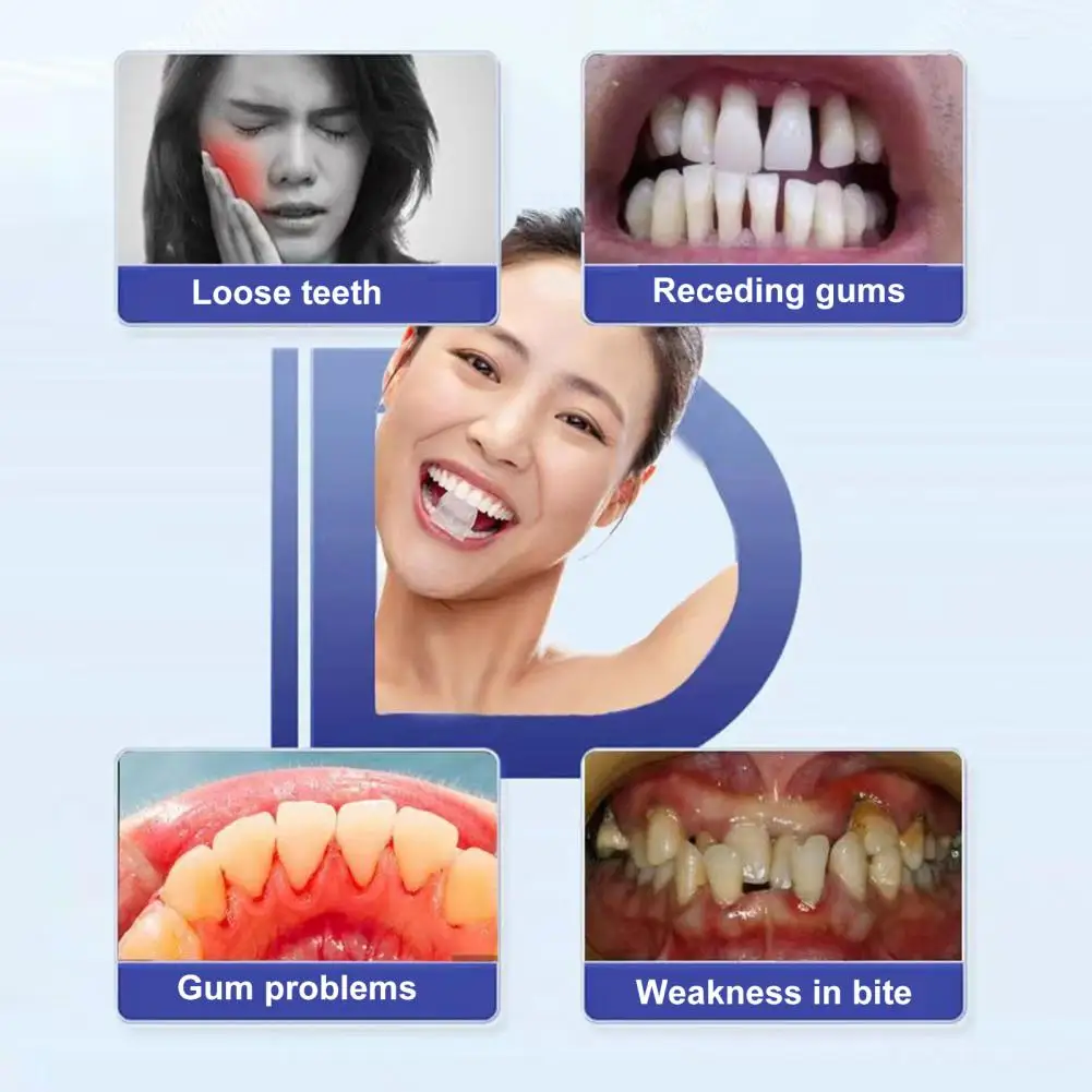 Creme dental eficaz do reparo da goma, impede a cárie dentária, sangramento, inchaço, prevenção, remoção de mancha, clareamento