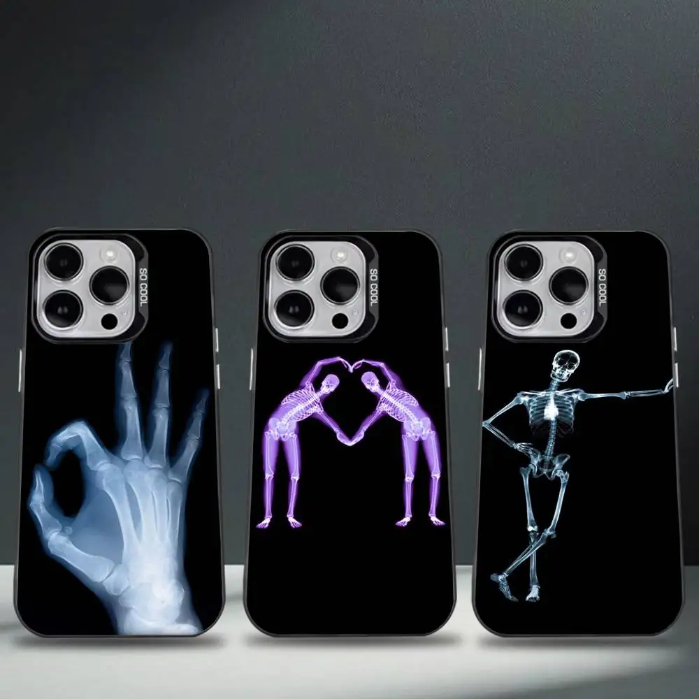 

X-RAY Radiological Skeleton Phone Case For iPhone 16,15,14,13,12,11,8,7,Pro,Max,Plus,Mini,XS,SE Anti Fall Black Matte Hard