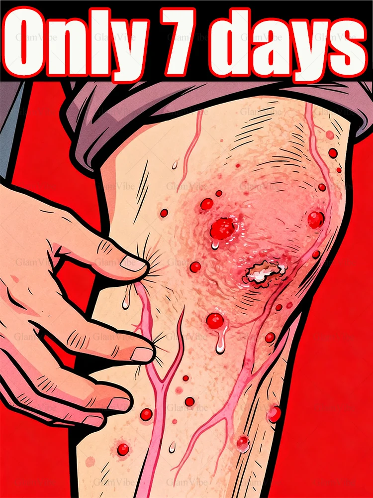 

Варикозное расширение вен на ногах, унисекс