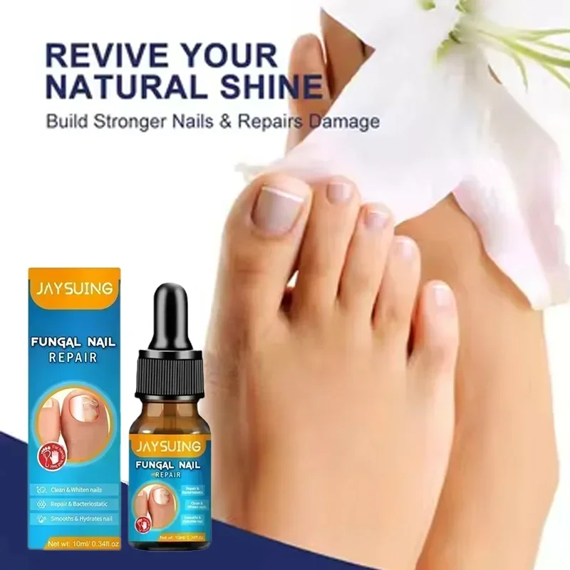 Fungal Nail Removal 10ML Fungal Nail Treatment Oil Foot Repair Essence Toe Nail Fungus Removal Gel Anti Infection Cream