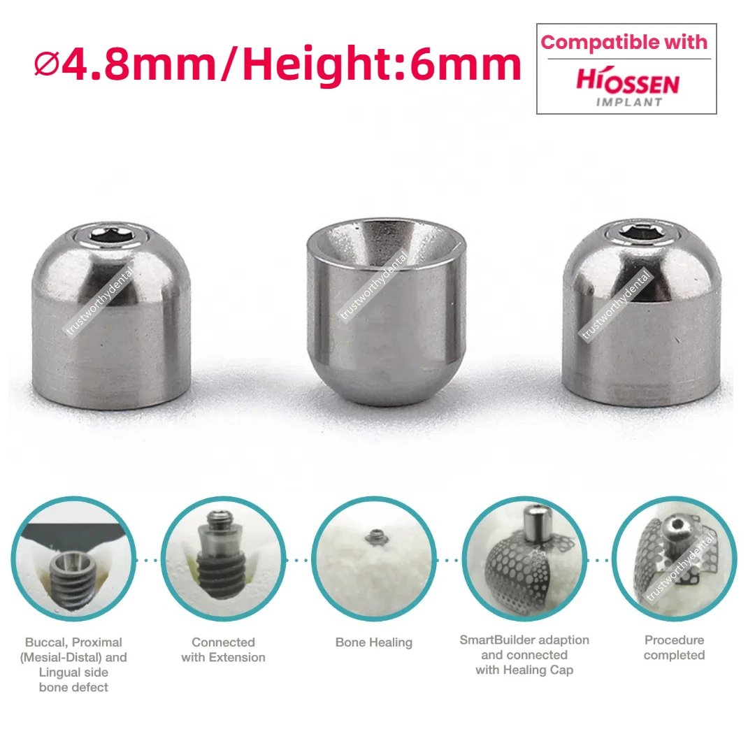 10Pcs Dental Smartbuilder Cover Cap Φ4.8 Multi Unit Protective Caps 1-Stage Compatible with OssBuilder