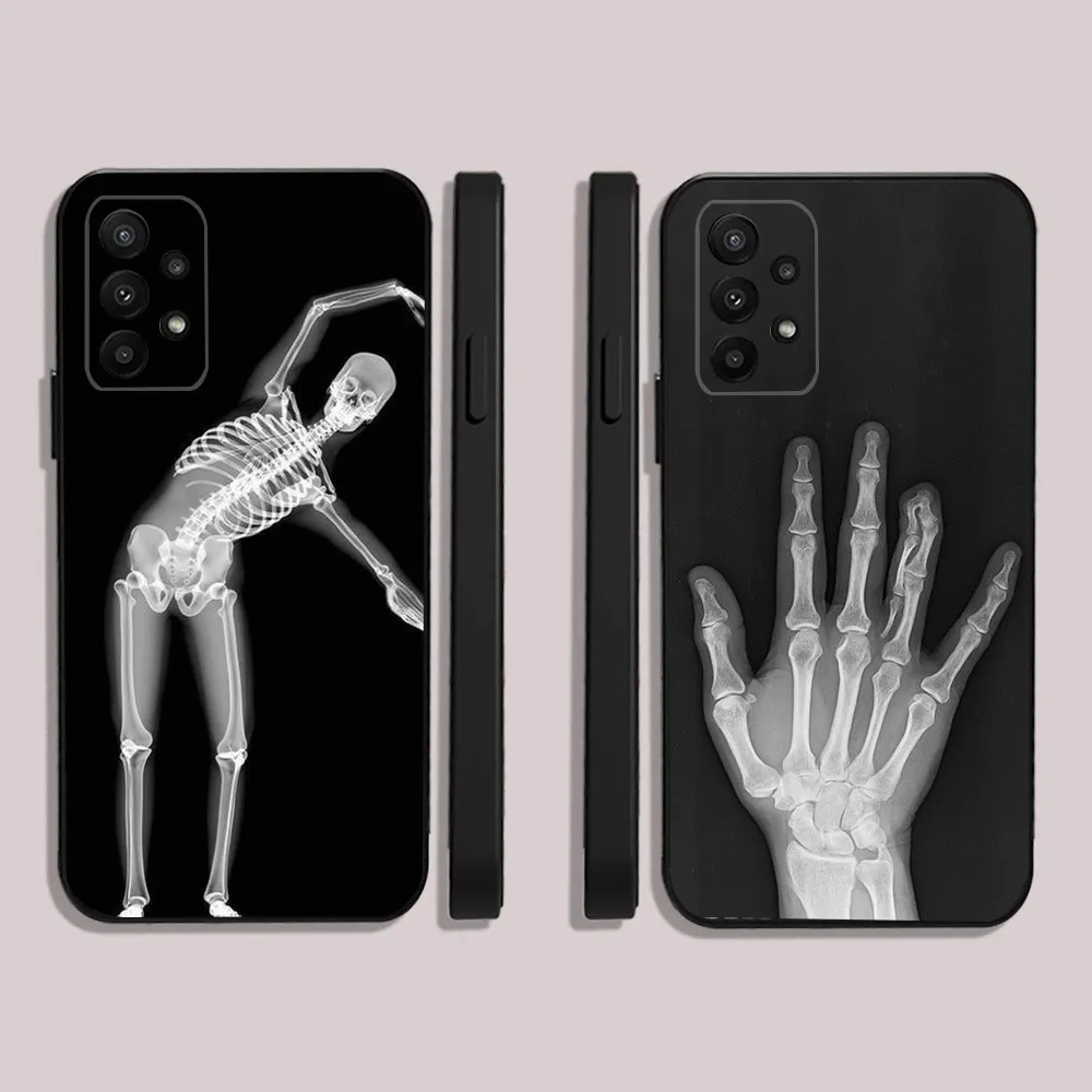 Radiological Human Skeleton Phone Case For Samsung S24,23,22,30,21,10,9,Ultra,Plus,Lite,FE,5G Black Soft Case