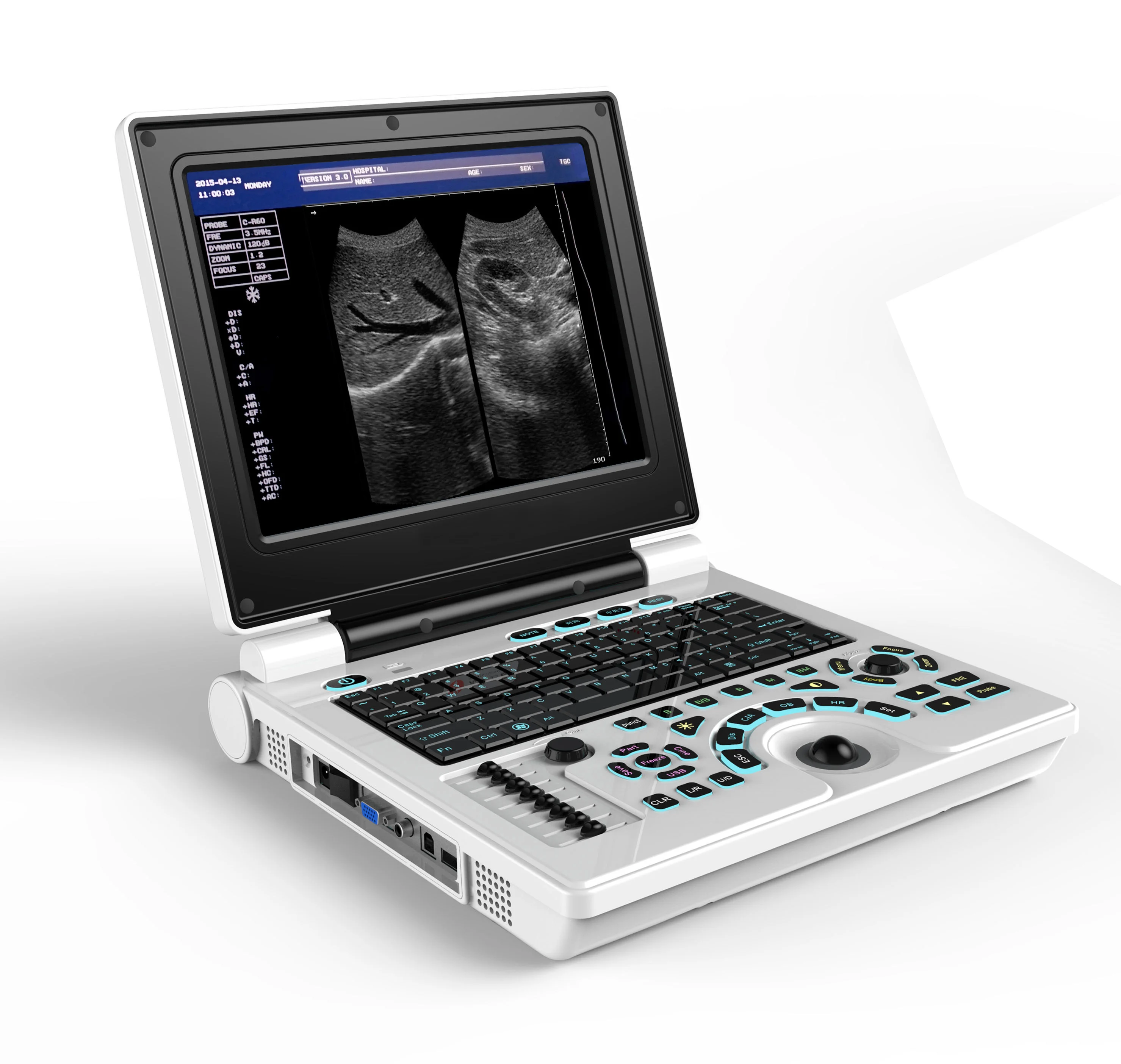 

One-Stop Supplier Notebook B/W Ultrasound 12" Led Screen Human & Animal Use Ultrasound Scanner Machine For Hospital