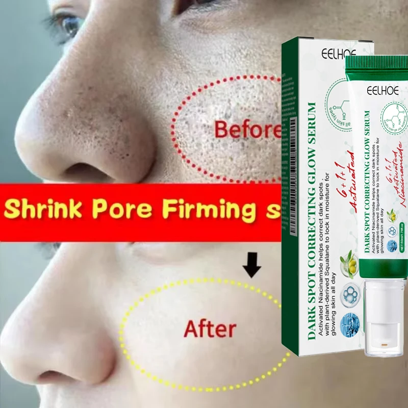 Pore Shrinking Cream Acne Pit Repair Product for Men Women Remove Acne Print Scar Large Pore Anti-inflammatory Smooth Skin Cream