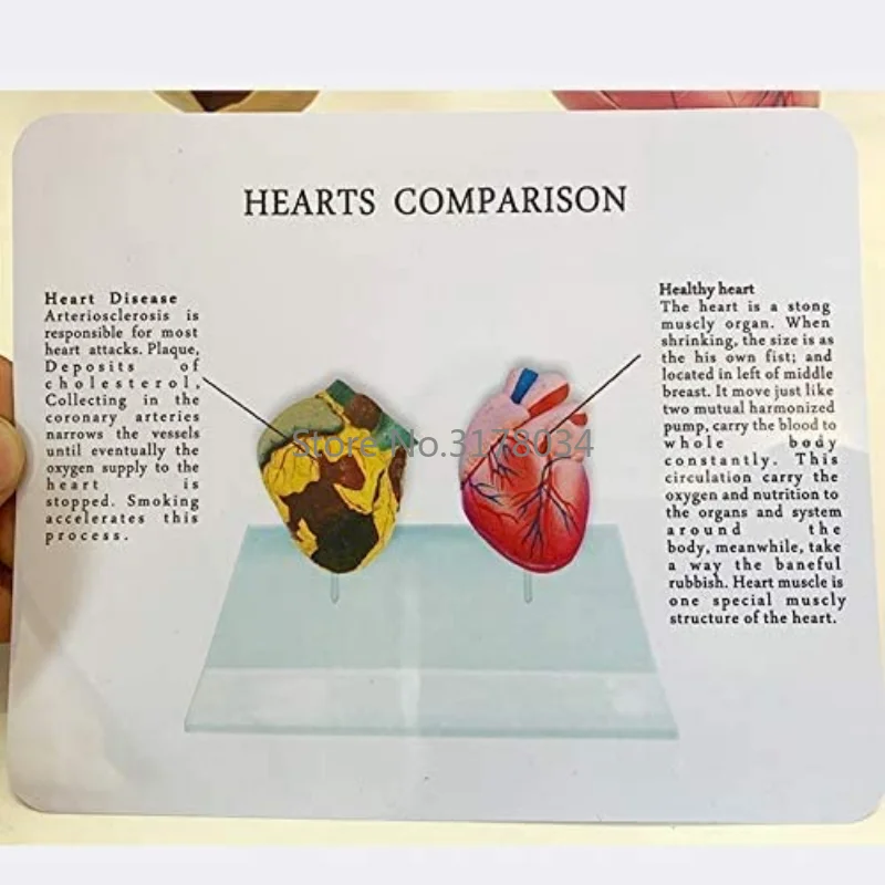 Human Heart Model Pathological Anatomical Heart Model Health and Smoking People Heart Comparison Model