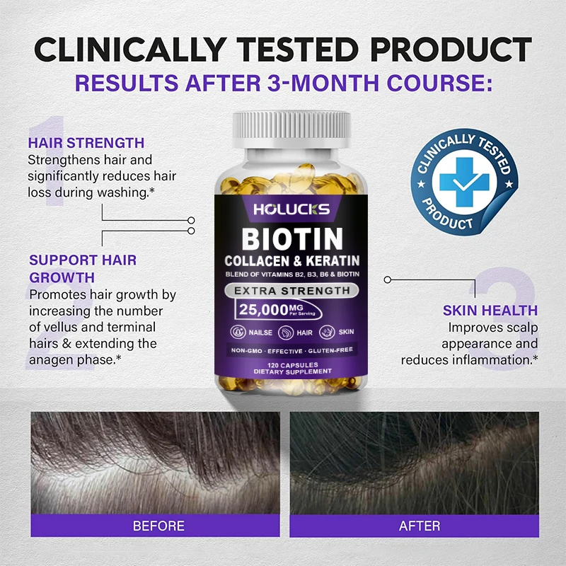 Biotin | Collagen | Keratin - Hair Growth Support - Skin & Nails Complex - Hyaluronic Acid | B2 | B3 | B6 | B7 - For Women & Men