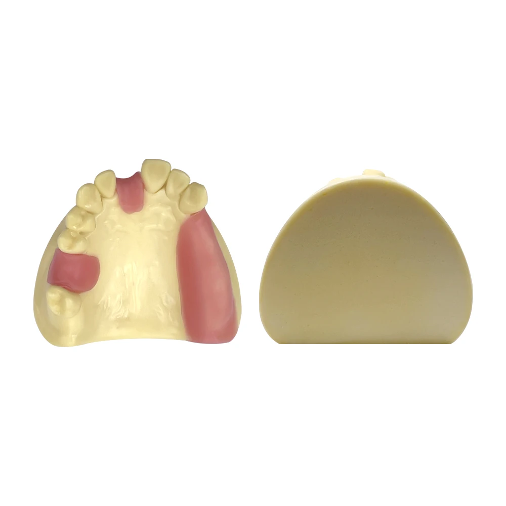 Modèle d'implant dentaire fuchsia, modèle de pratique du sinus maxillaire, dent manquante, étudiant dentiste, démonstration d'étude