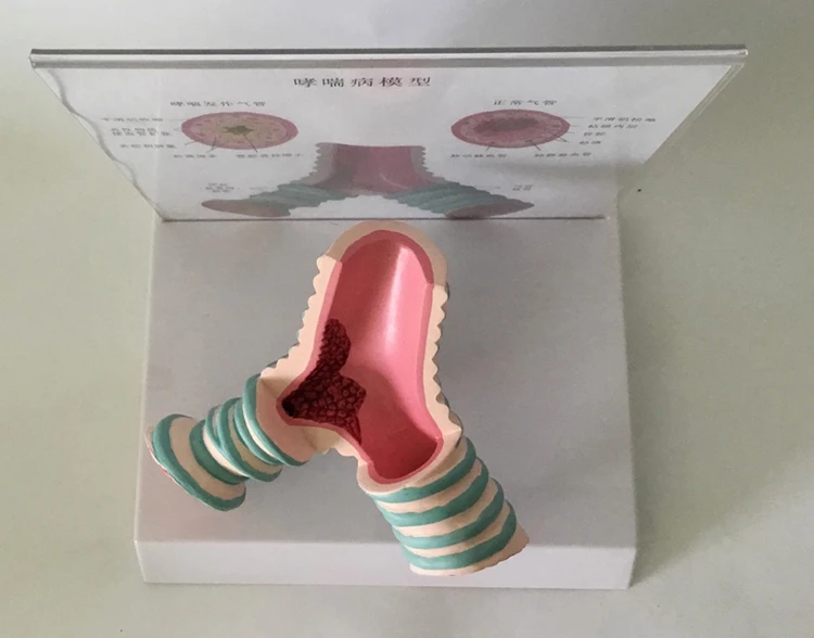 Human asthma trachea anatomy model bronchial model medical model