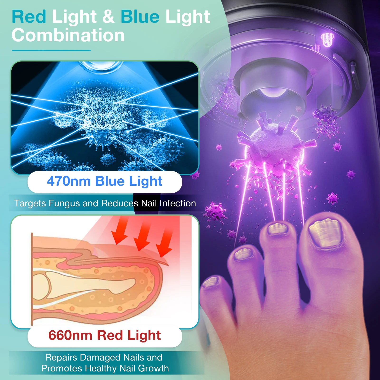 Wireless Nail Fungus Laser Device One Size Fits All 2000mAh 36pcs LED 470nm 660nm Nail Laser Treatment Device for Onychomycosis