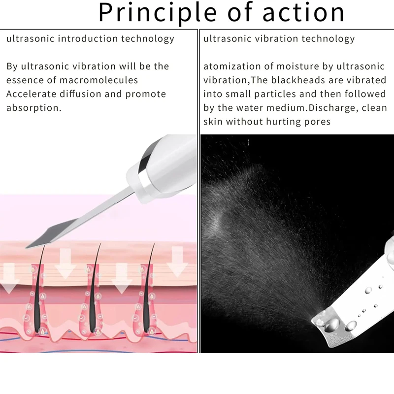 EMS جهاز تردد الراديو لجسم الوجه لشد الجلد وشد الوجه جهاز التجميل RF المهنية المنزل RF العناية بالبشرة مكافحة الشيخوخة #6