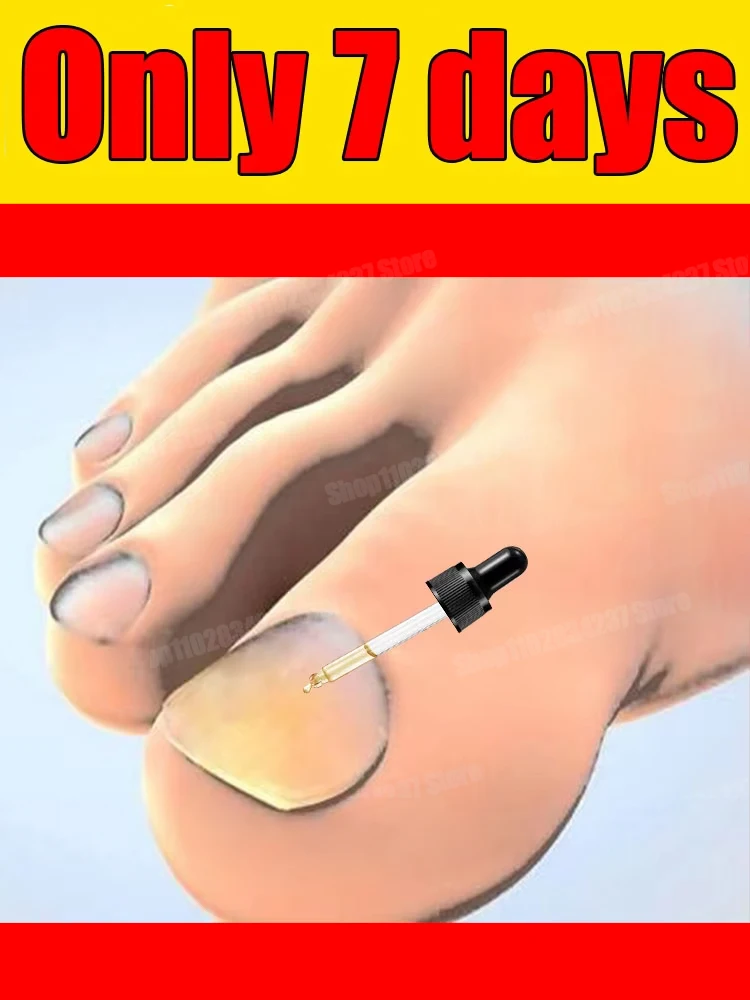 

manicure for bad Can in 7 days farewell