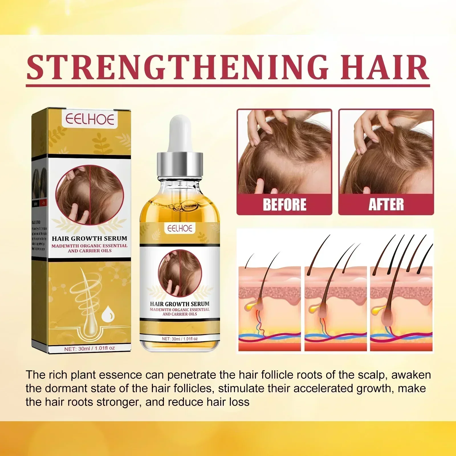 Hot sales Fast Hair Growth Oil Repair Hereditary Hair Loss Postpartum Seborrheic Hair Loss Oil Rapid Growth Care