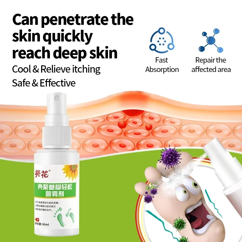 Foot Odor Tinea Pedis Treatment Spray Remover Feet Sweat Beriberi Athlete Foot Peeling Anti Fungal Itch Inhibits Fungus Medicine