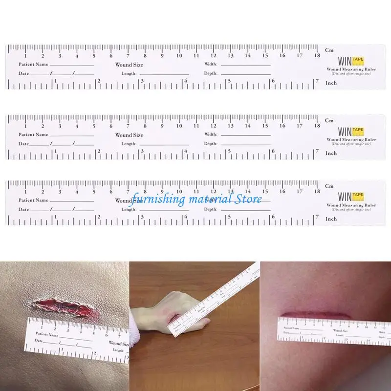 

Y5GD Wound Measurement Tools Educare Measuring Tape dical Measurement Ruler 100 Pack Measuring Babies for Head