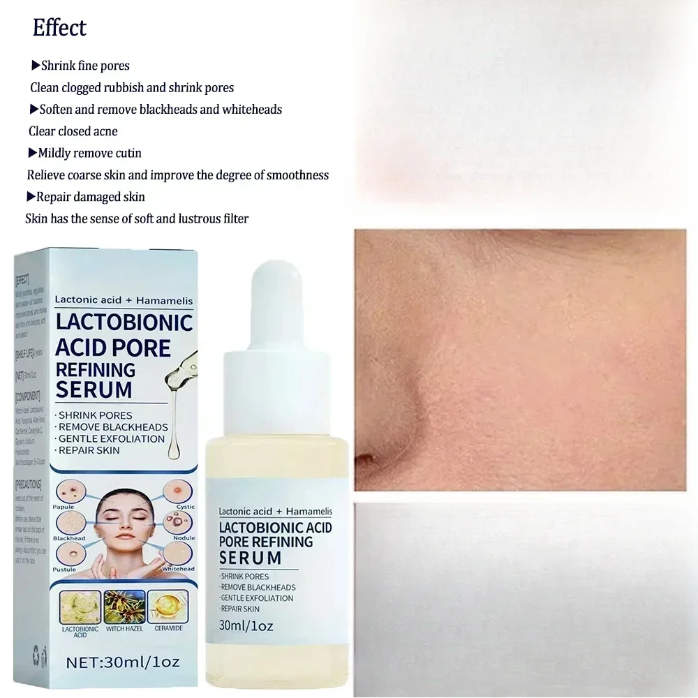 Suero reductor de poros con ácido lactobiónico, suero reparador y reafirmante para el rostro, Control de aceite hidratante, cosmético para el cuidado de la piel