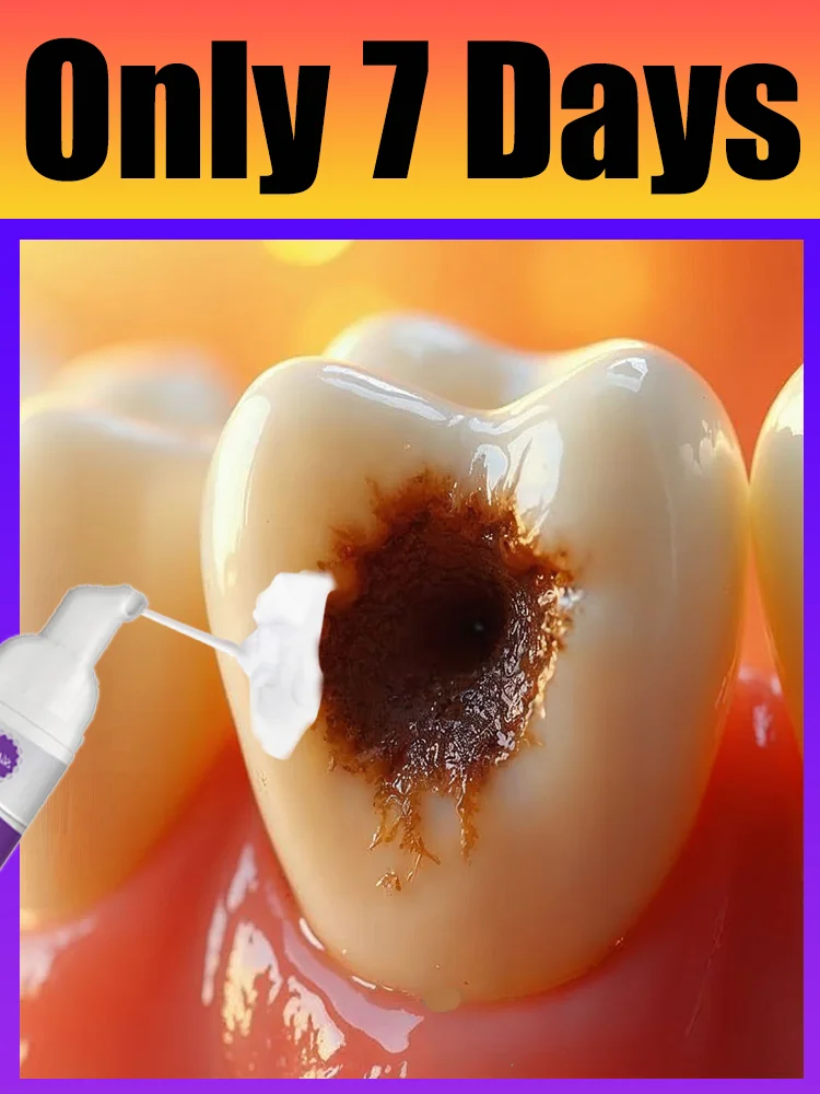 

2025 Intraoral care tools White foam upgraded