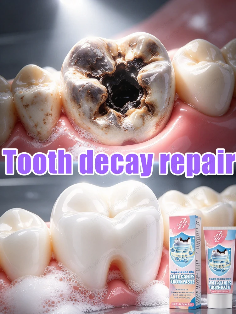 Cavity Protection Toothpaste for Sensitive Teeth Oral Care