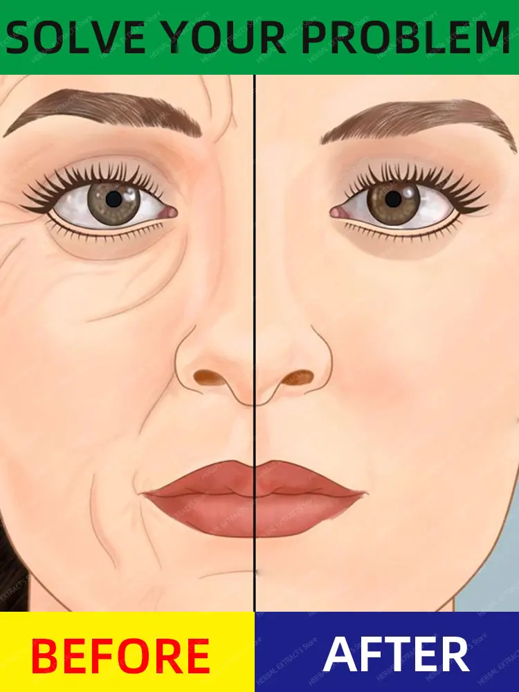 

Без морщин, наука молодости