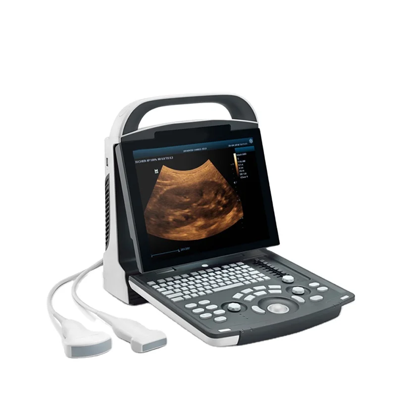 

Products subject to negotiationMindray DP 10 Ultrasound Machine Portable Mindray DP-10 Ultrasound Scanner Laptop Ultrasound