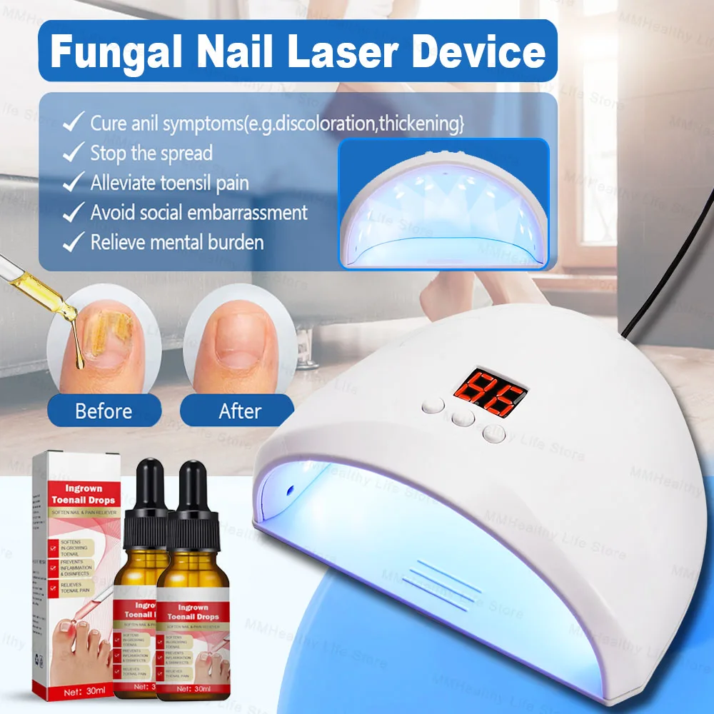 Fungal Nail Laser Device Fast Repair Essence Oil Repair Toenail Fingernail Treatment Onychomycosis with Mushrooms Foot Care