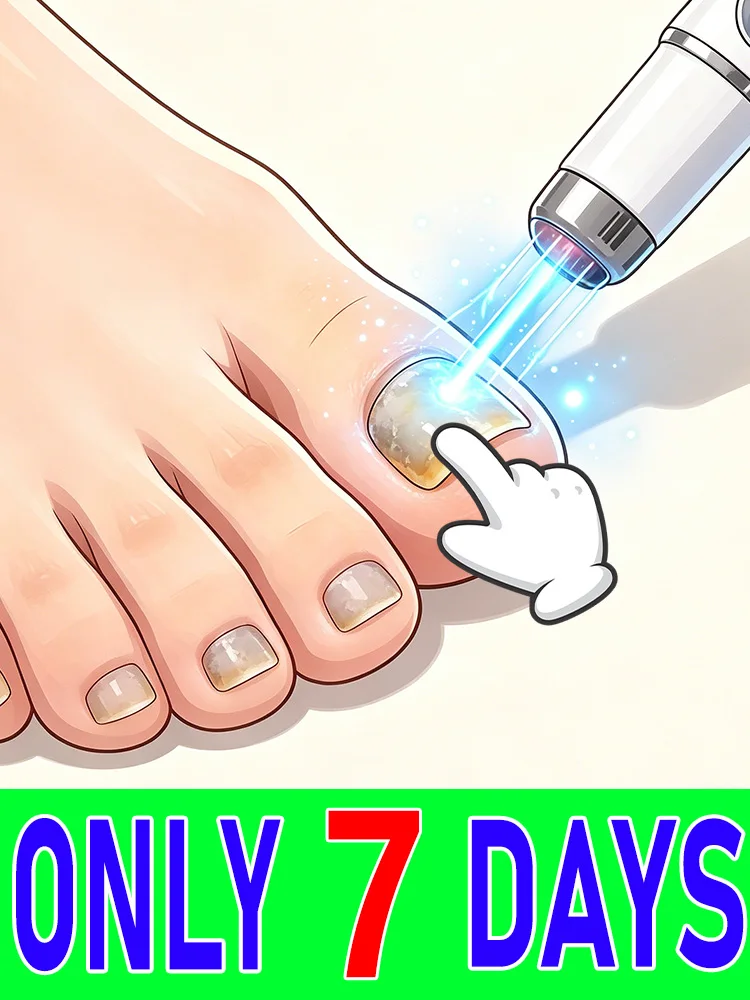 

Safe gentle non-irritating professional grade nail laser pen gradually restores natural smooth and shiny nail appearance