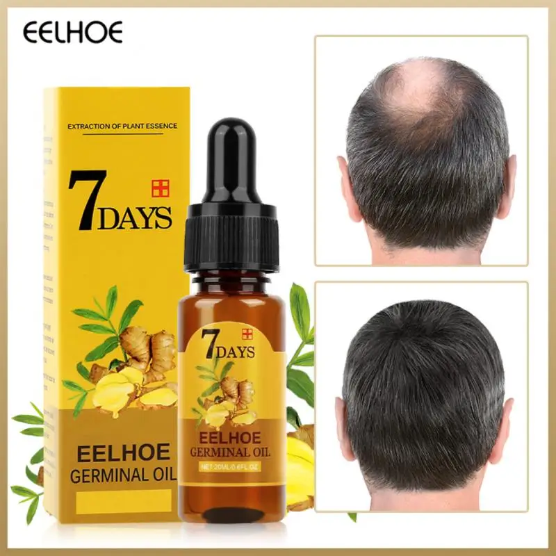 Ginger Hair Growth Products Effective Prevent Hair Loss Essential Oil Fast Growing Scalp Treatments Beauty Health For Men Women