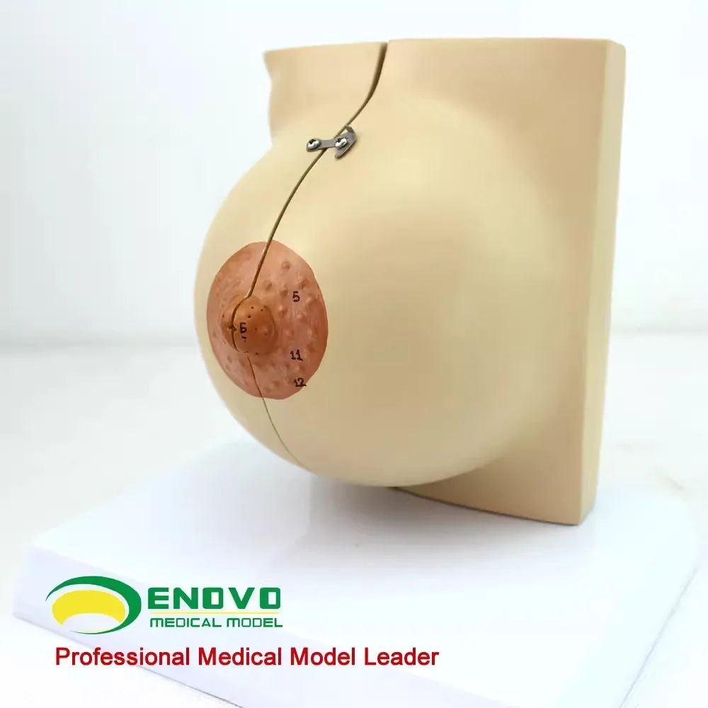 

ENOVO Medical Female Static Stage Breast Model Breast Anatomy Breast Enhancement Gynecology And Obstetrics Teaching Tool