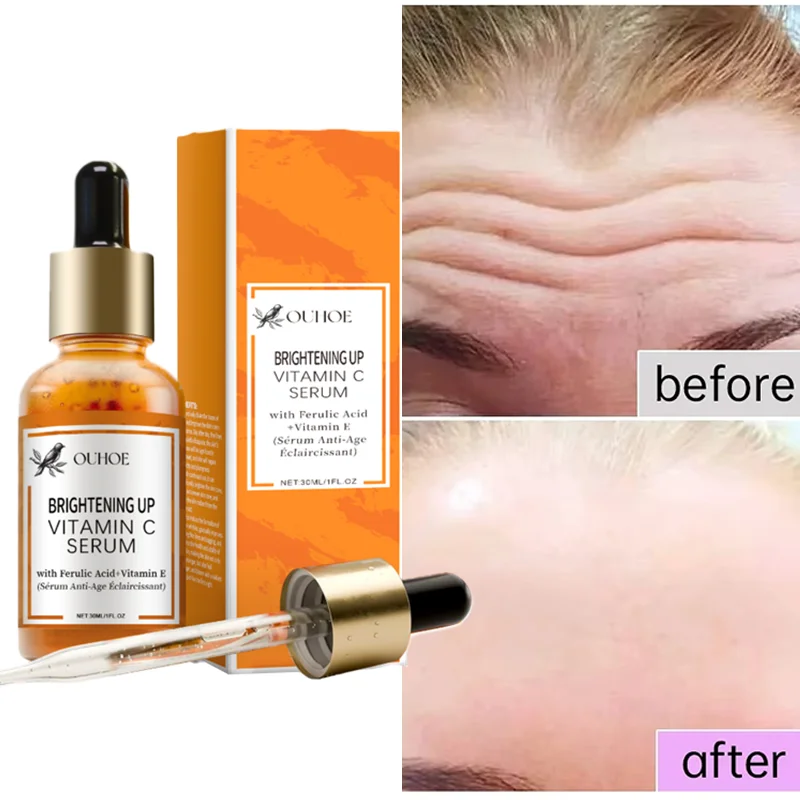 

Vitamin C Anti-Wrinkle Essence Lifting Firming Tightening Repair Improve Nourishing Serum Fast Absorption Antioxidant Skincare