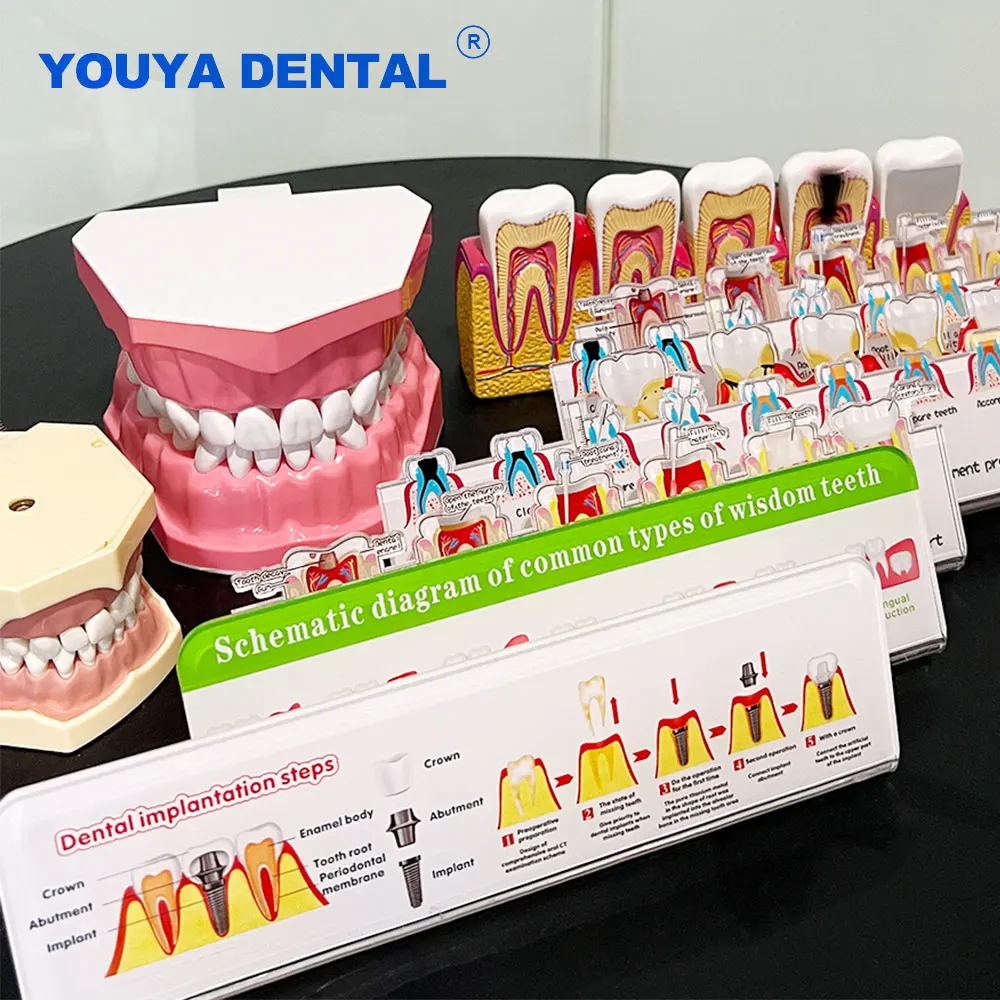 Dental Endodontic Treatment Flowchart Stand Root Canal Teeth Model Dentist Study Teaching Model Clinic Decoration