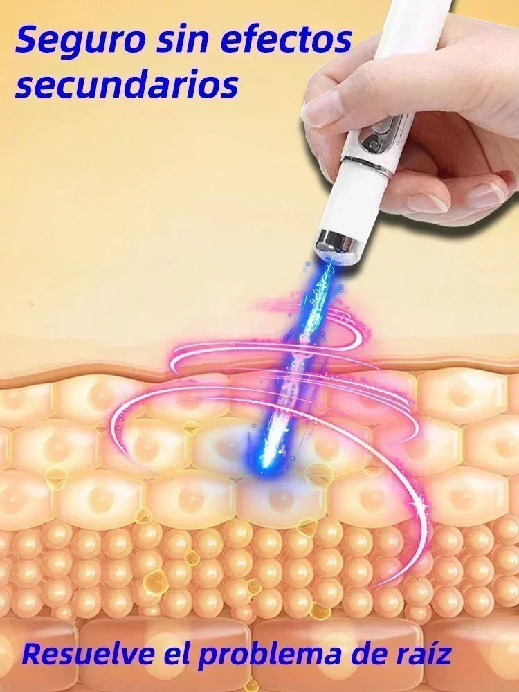 Laser Therapy Keloid Scar Improve Keloid Scar Pen Scar Relief Easy Harmless Laser Pointer