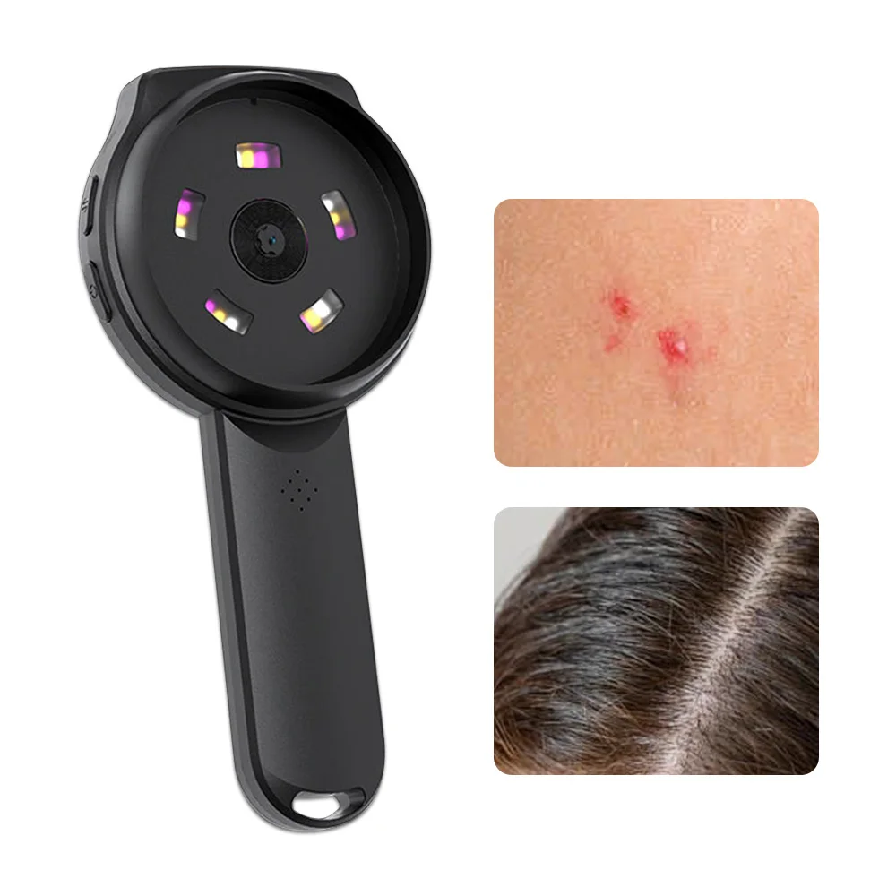 200X цифровой микроскоп беспроводной электронный дерматоскоп для обнаружения кожи головы лупа анализатор кожи лица машина профессиональная 200X цифровой микроскоп беспроводной электронный дерматоскоп для обнаружения кожи головы лупа анализатор кожи лица машина профессиональная