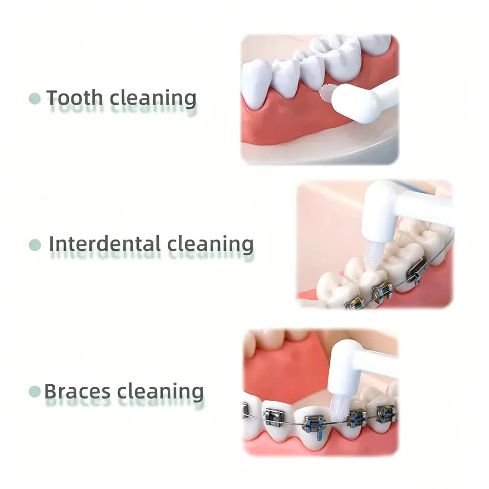 8 Colors Orthodontic Toothbrush, Single Beam Head Brush for Braces, Wisdom Teeth, Interdental & Groove Cleaning