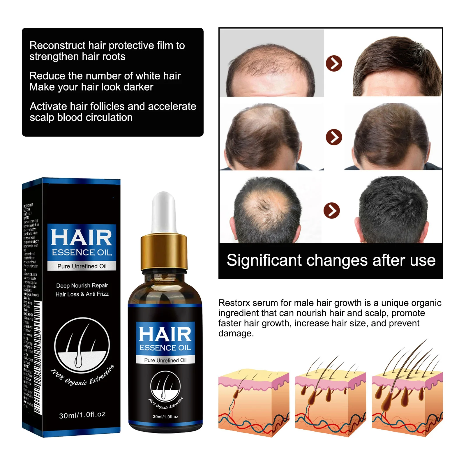 Hair Growth Oil Effective Rapid Repair Fast Baldness Postpartum Hair Loss Follicles Hereditary Loss Hair Care Solution view 4