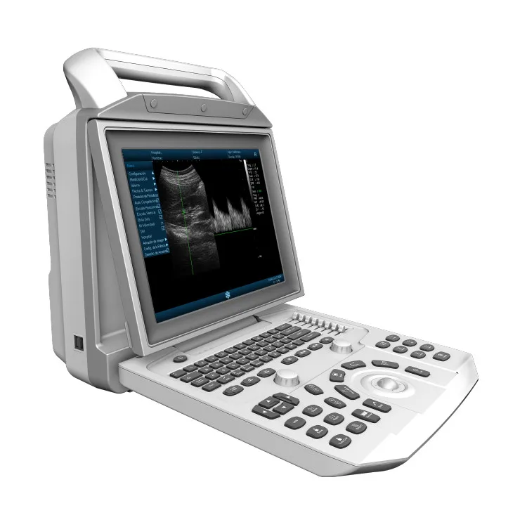 

Medical Ultrasound Instruments Black And White Trolley Hospital Ultrasound Diagnosis System Medical Ultrasound Scanner