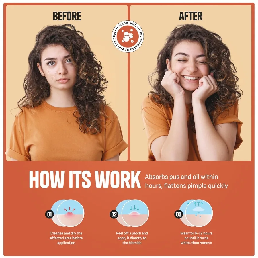 여드름 패치 데이 나이트 하이드로콜로이드 여드름 스티커 빠른 치유 피부 정화 투명 방수 스팟 트리트먼트 6개입