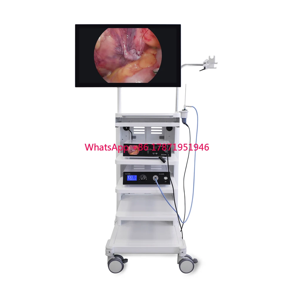 TUYOU 2024 New Design 4k HD Medical Endoscopic Endoscope Camera System With Monitor For Surgery with All Accessories