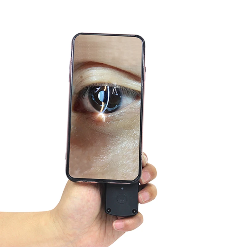 New Ophthalmic Equipment Portable Handheld Slit Lamp S150 Slit Lamp Microscope