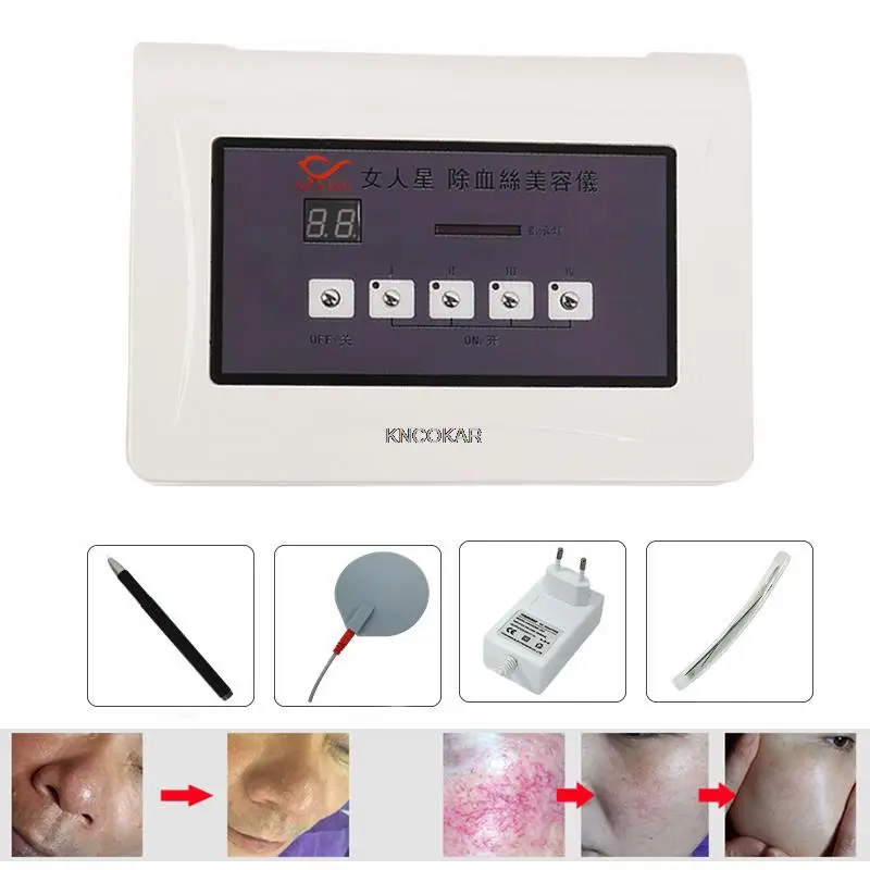 ใหม่สีแดงเลือดจุดหลอดเลือดกําจัดอุปกรณ์ความงามความถี่สูง Spider Veins Removal Anti Redness เครื่อง