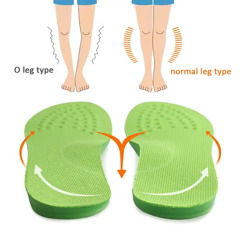 O/X-Leg Orthopedic Arch Support Insoles Orthopedic Insole Valgus Varus Shoe Pads Massaging Pad for Shoes Inserts Sole Feet Care