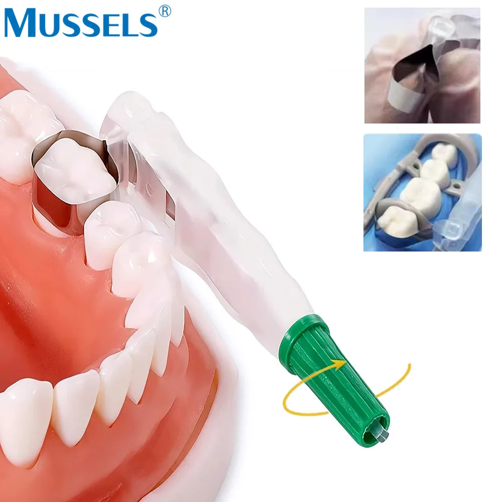 Adjustable Dental Pro Matrix Bands Pre Formed Sectional Metal Matrice Ring Molar Restoration Teeth Filling Retainer Dentist Tool