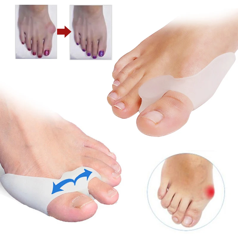 2 pares/lote dedo do pé separador alisador corretor de dedo do pé alívio hálux valgus correção osso polegar ferramentas cuidados com os pés