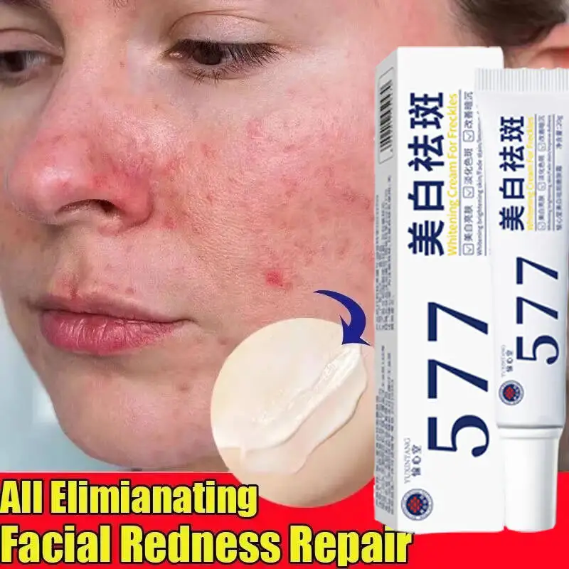 Repair Facial Redness Cream Instant Spider Vein Remove Sensitive Skin Sooth Anti Redness Rosacea Treat Lotion Korean Cosmetics