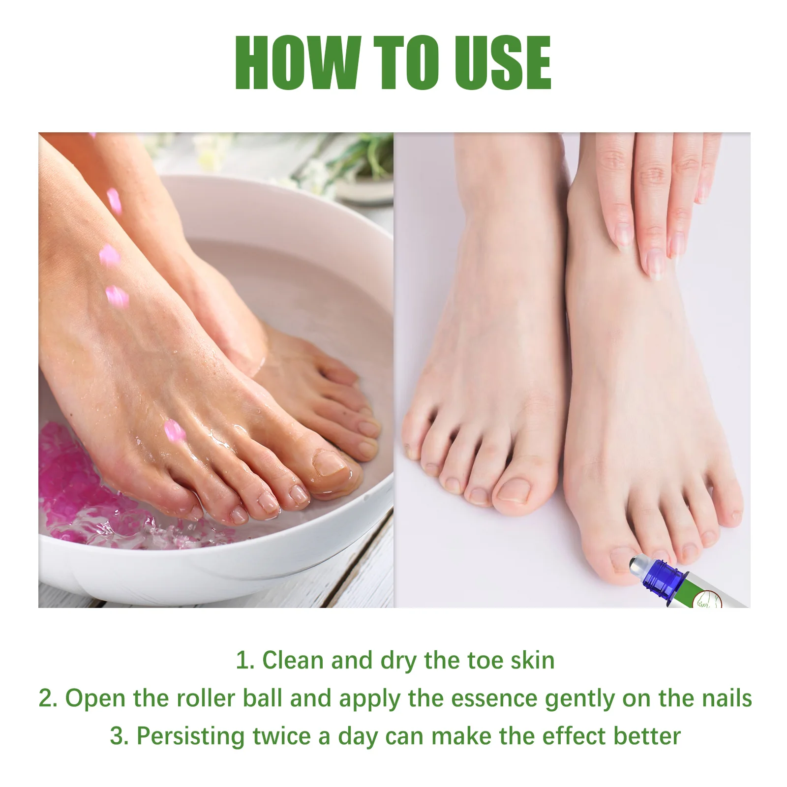 Nail Fungus Infection Inhibiting Care Roller Daily Cleaning Softening Nail Correcting Distorted Nails Hand Foot Nail Brightening