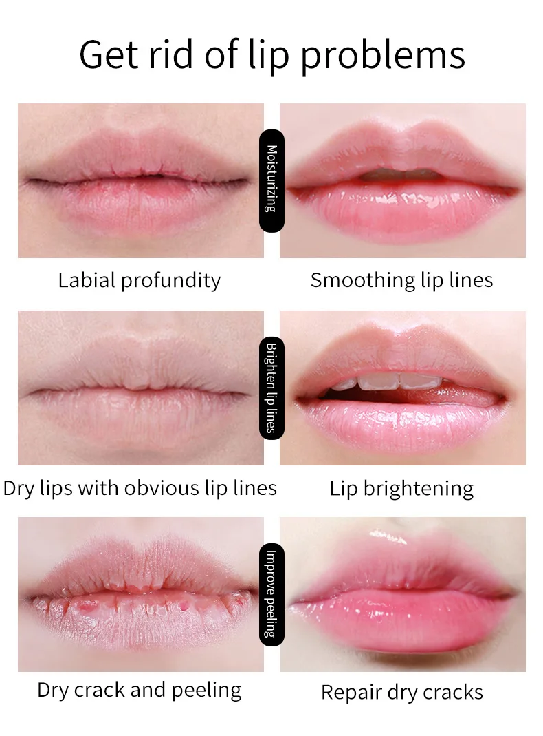 Lemon Lip Balm Moisturizing Lip Care Lipsticks Lip Lightening For Dark Lips Exfoliating Lips Darkness Remover Korean Cosmetics