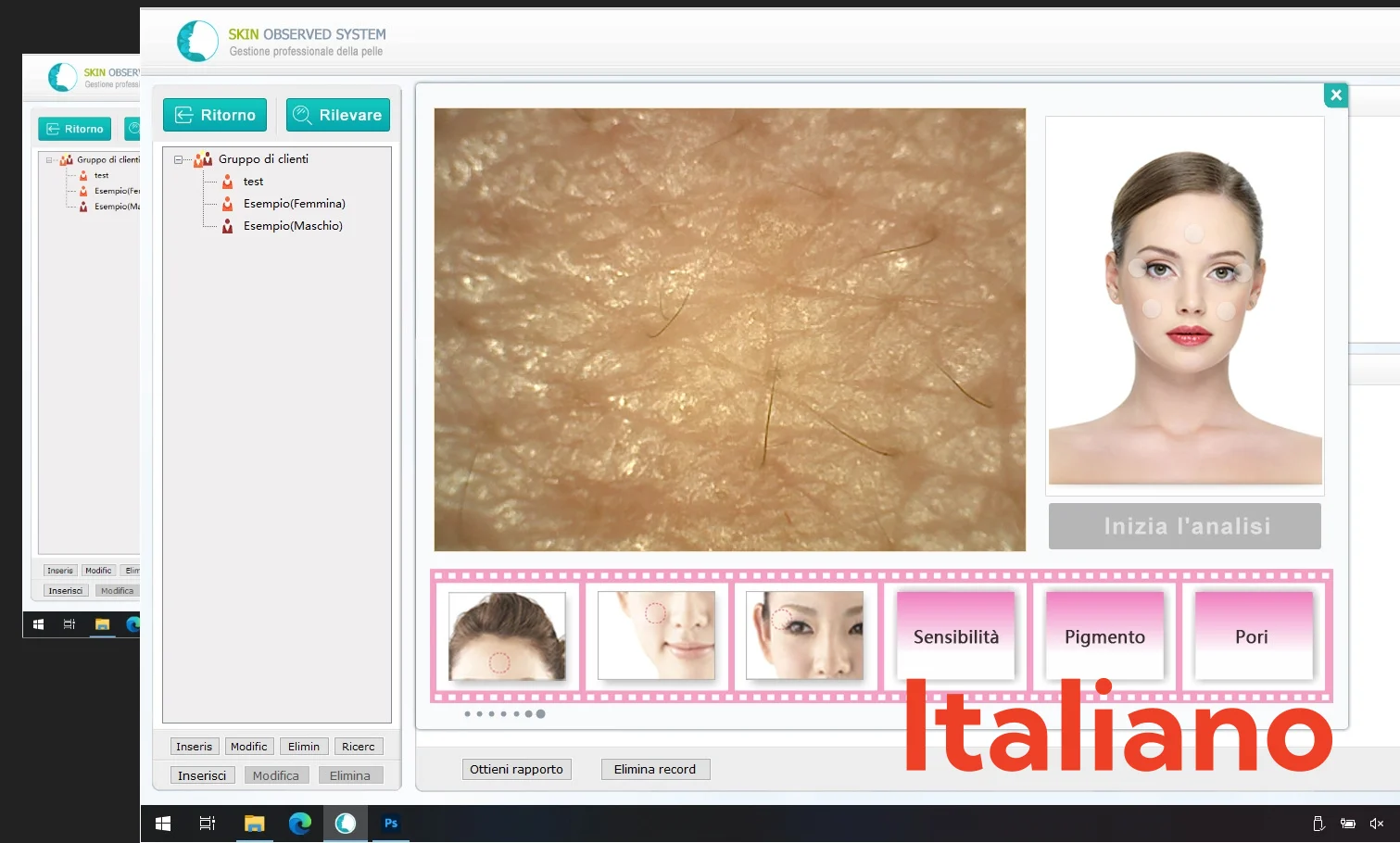 Multi Languages Professional Intelligent Skin Diagnosis Facial Analyzer 3D Skin Microscope Detector For Windows System